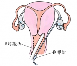 幼儿学画画，深圳捐卵宝宝学画画，学画画的好处，如何学画画