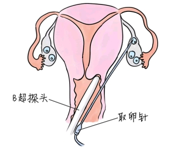 幼儿学画画，深圳捐卵宝宝学画画，学画画的好处，如何学画画